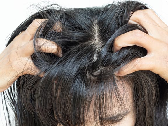 Dandruff & Scalp Condition Management hairline definition (20)