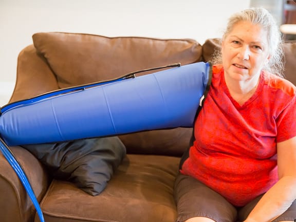 Lymphedema hairline definition 2026 01 05t132717.660