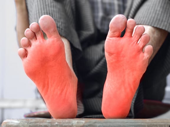 Neuropathy hairline definition 2026 01 05t133007.414