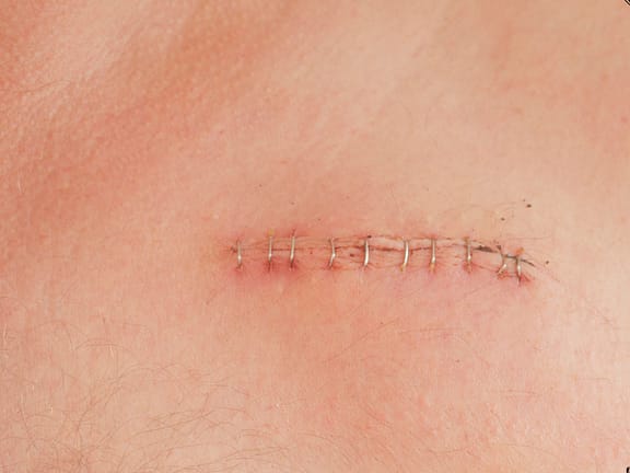 Wound Healing Issues hairline definition 2026 01 05t151448.624