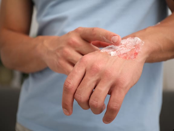 Wound Healing Issues hairline definition 2026 01 05t151607.723