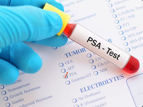 Prostate Health Screening hairline definition 2026 01 06t002804.356