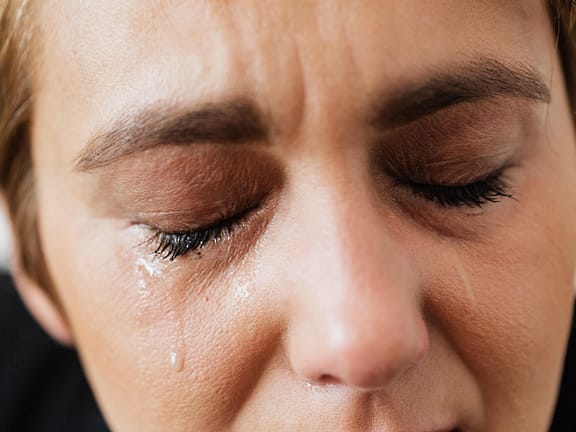 Tear Trough Correction hairline definition 2026 01 06t103123.841