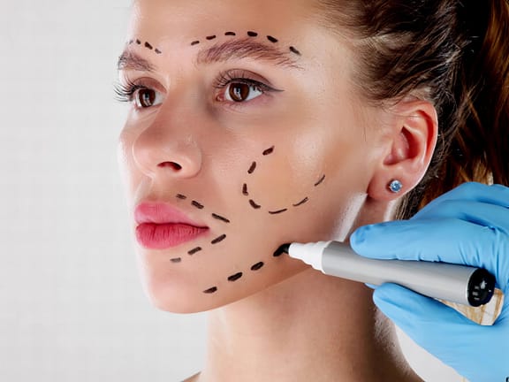 Non-Surgical Rhinoplasty hairline definition 2026 01 06t104023.046