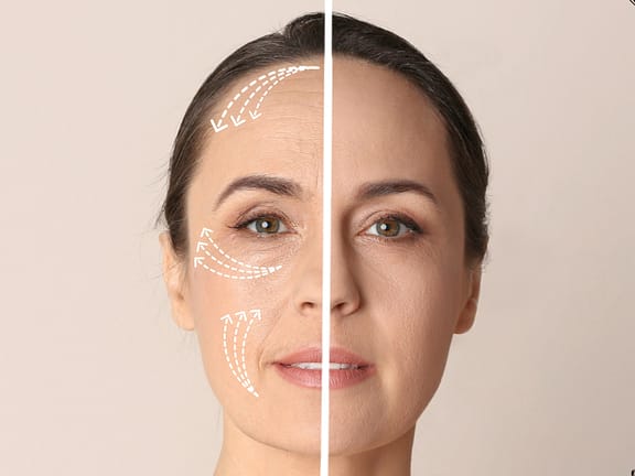 PRP Facial (Vampire Facial) hairline definition 2026 01 06t110759.278