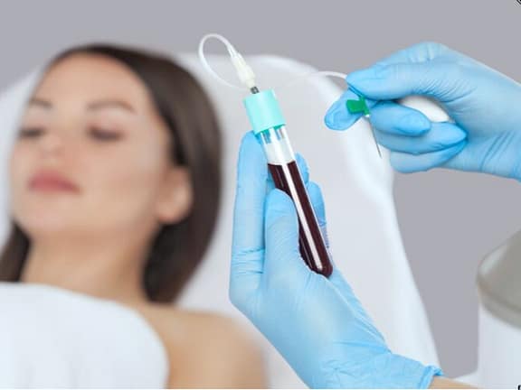 PRP Injectables (Musculoskeletal & Aesthetic) hairline definition 2026 01 06t114719.469