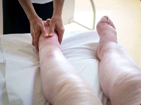 Lymphedema Therapy hairline definition 2026 01 06t131741.594