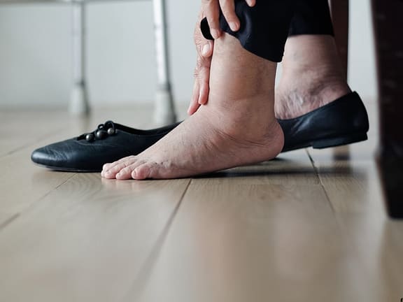 Lymphedema Therapy hairline definition 2026 01 06t131825.599