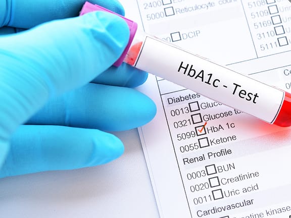 Diabetes Diagnostic Testing hairline definition 2026 01 06t140400.505