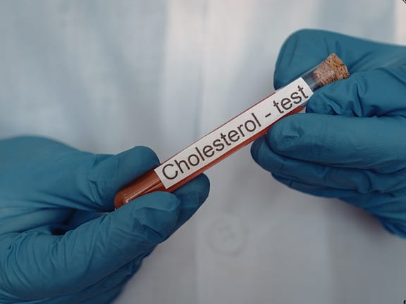 Cholesterol & Lipid Panel Management hairline definition 2026 01 06t163345.264