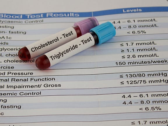 Cholesterol & Lipid Panel Management hairline definition 2026 01 06t163409.386