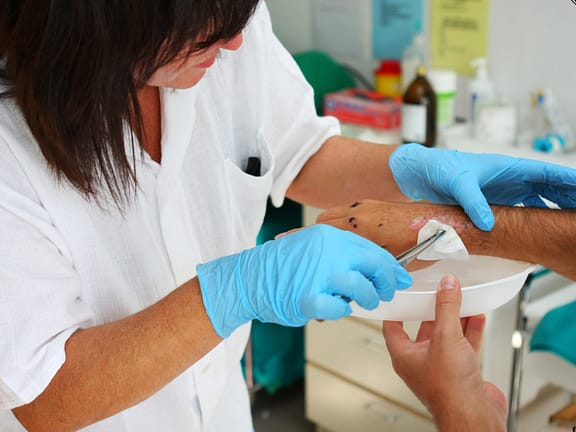 Wound Care Management hairline definition 2026 01 07t110954.227