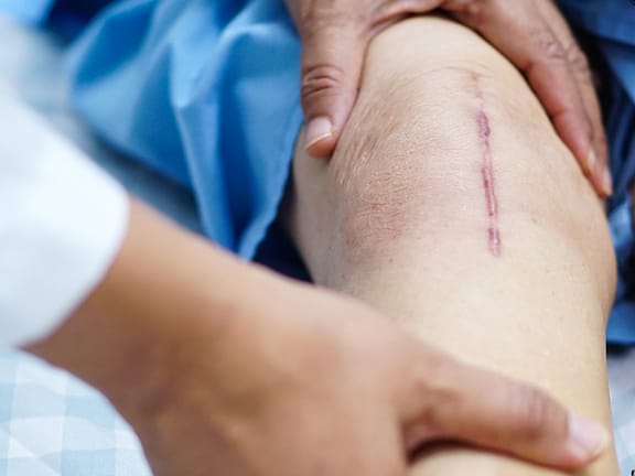 Wound Care Management hairline definition 2026 01 07t111304.635