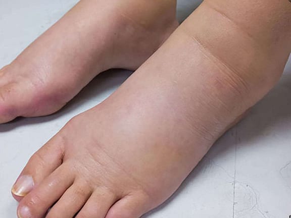 Compression Therapy Services hairline definition 2026 01 07t114229.935