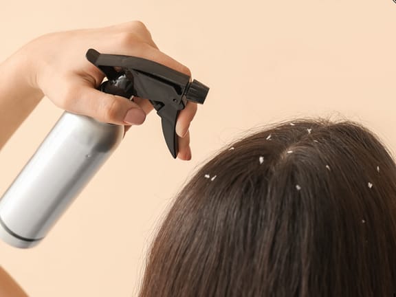 Dandruff & Scalp Condition Management hairline definition (24)