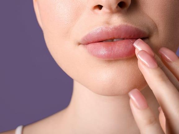 Lip Filler hairline definition (27)
