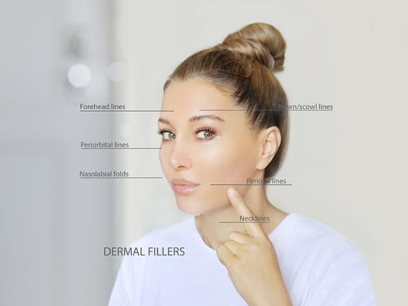 Dermal Filler hairline definition (33)