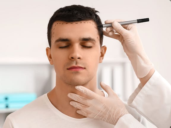 Hair Loss hairline definition (38)