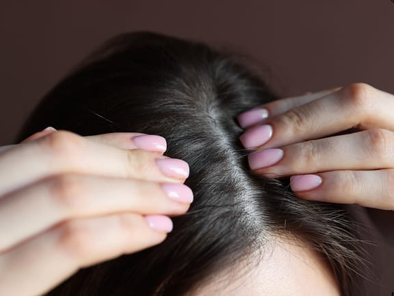 Hair Loss hairline definition (40)