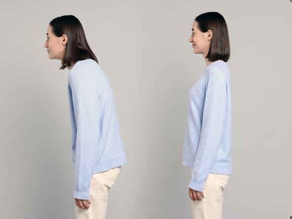 Neck & Back Pain hairline definition (66)