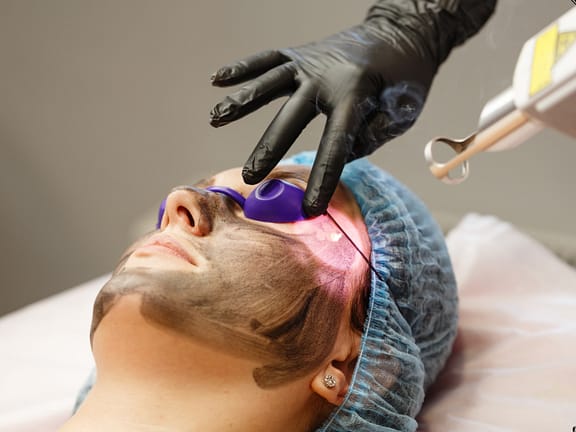 Low-Level Laser Therapy (LLLT) hairline definition (8)