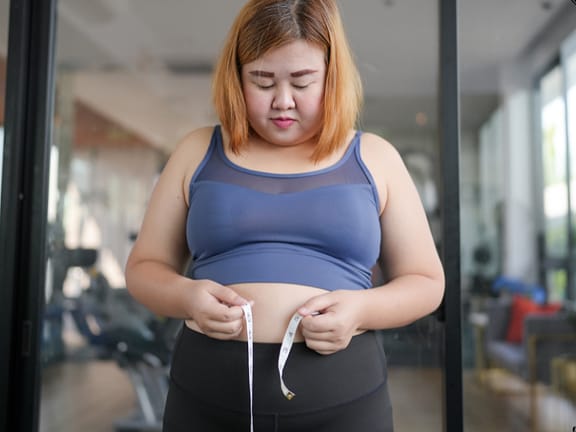 Weight Gain / Obesity hairline definition (82)