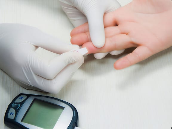 Diabetes & Prediabetes hairline definition (97)
