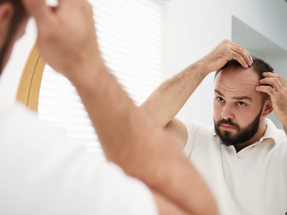 Scalp Micropigmentation hairline definition