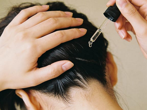 Hair Loss Solutions untitled design (81)